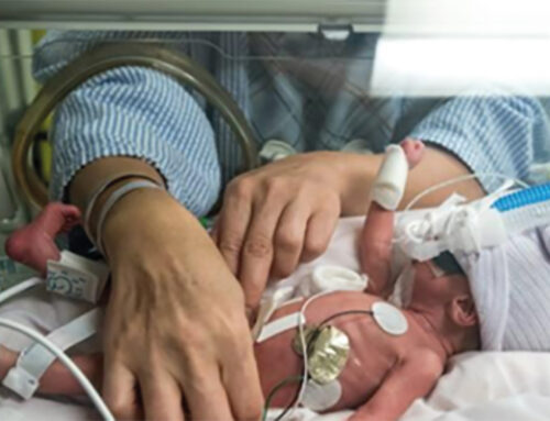 Pulpos para bebés prematuros